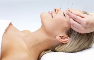 Acupunctura – Vindecare, Armonie, Evoluție Personală